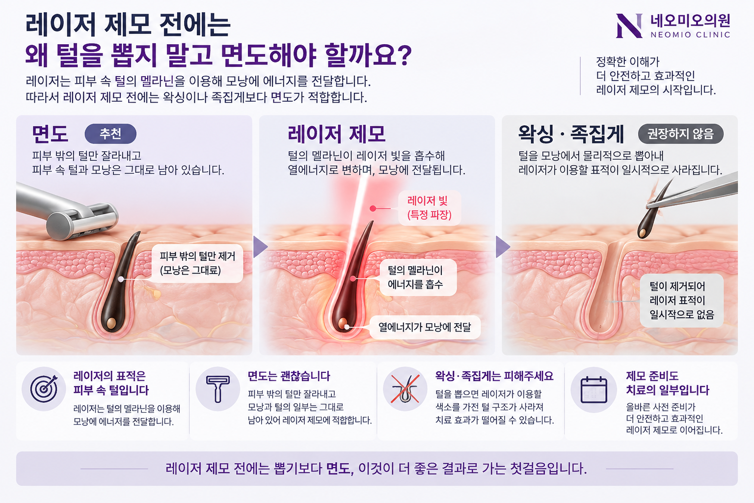 레이저 제모 전 면도와 왁싱의 차이 및 털의 멜라닌을 이용한 레이저 제모 원리를 설명한 이미지