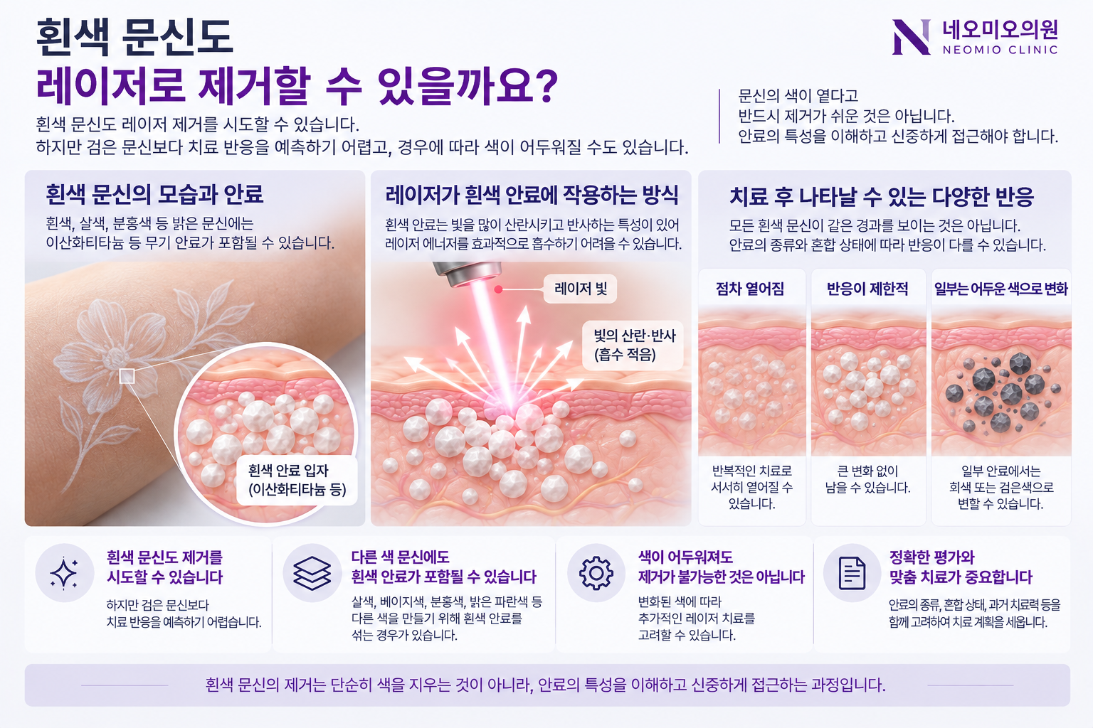 흰색 문신의 레이저 제거 과정에서 안료가 빛을 산란시키거나 치료 반응이 제한될 수 있고 일부에서는 어두운 색으로 변할 수 있음을 설명한 이미지