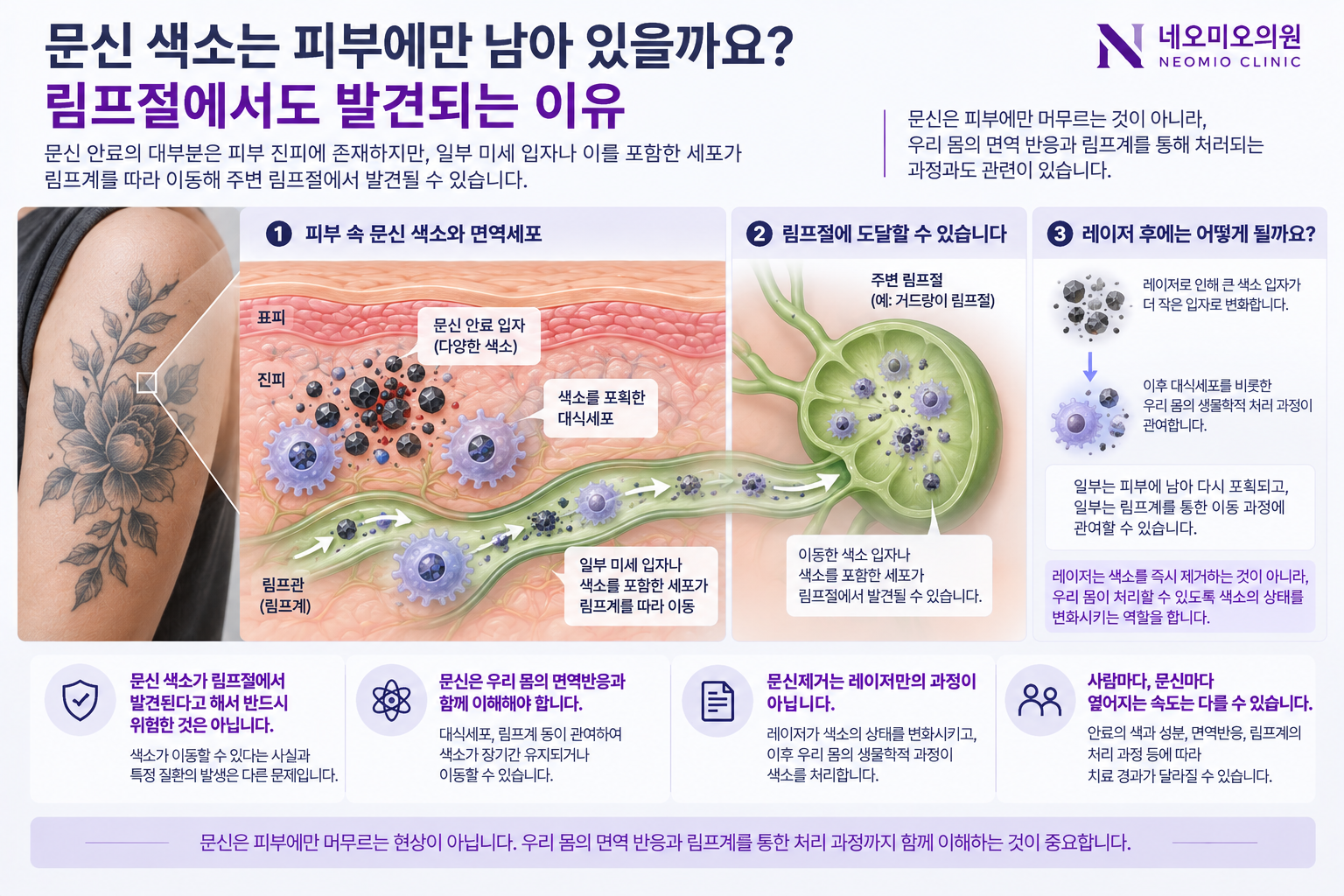 피부 진피의 문신 안료를 대식세포가 포획하고 일부 색소 입자와 세포가 림프계를 통해 주변 림프절로 이동할 수 있는 과정을 설명한 이미지