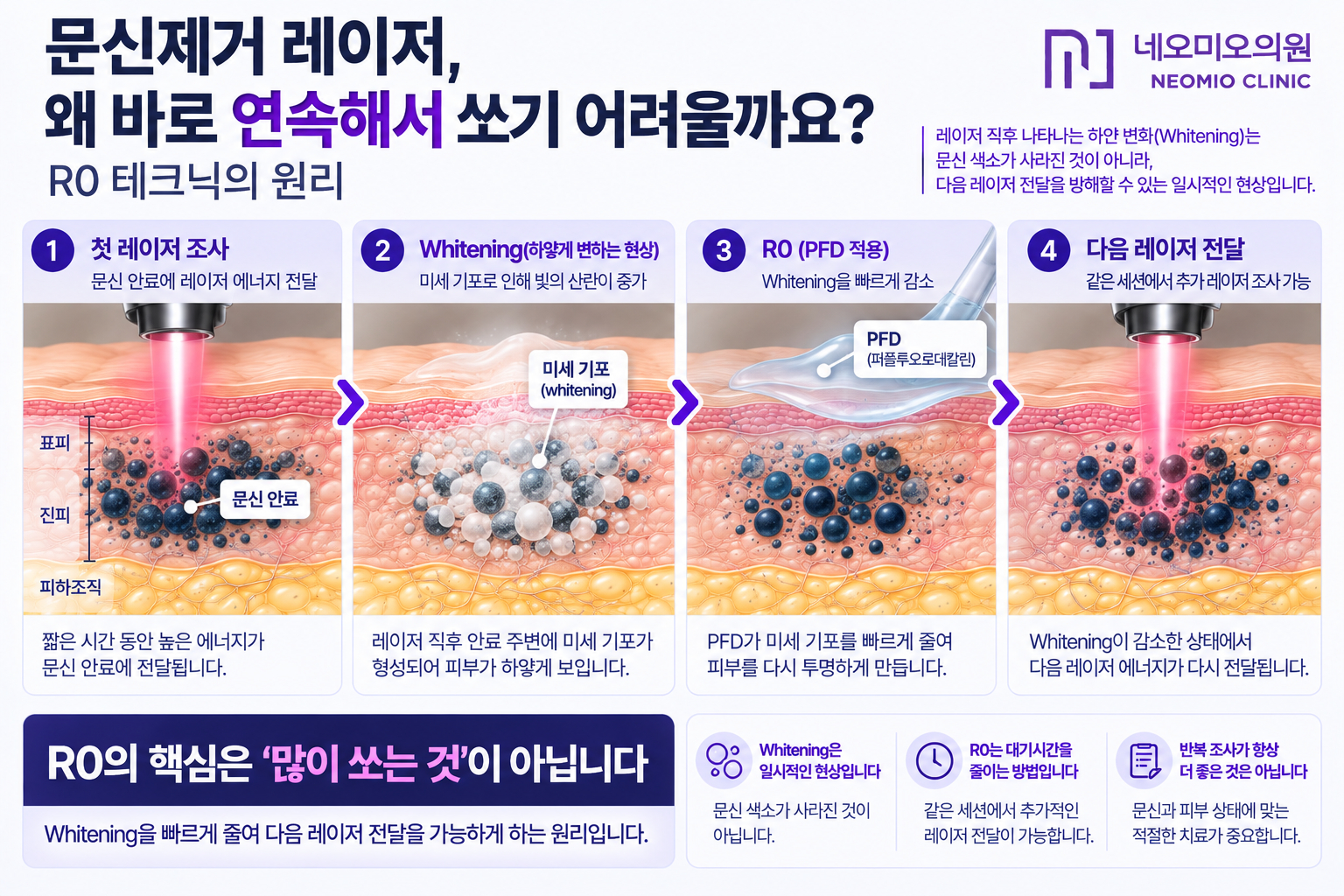 문신제거 레이저 후 발생하는 whitening과 미세 기포를 PFD로 빠르게 감소시켜 다음 레이저 에너지 전달을 가능하게 하는 R0 테크닉의 원리를 설명한 이미지