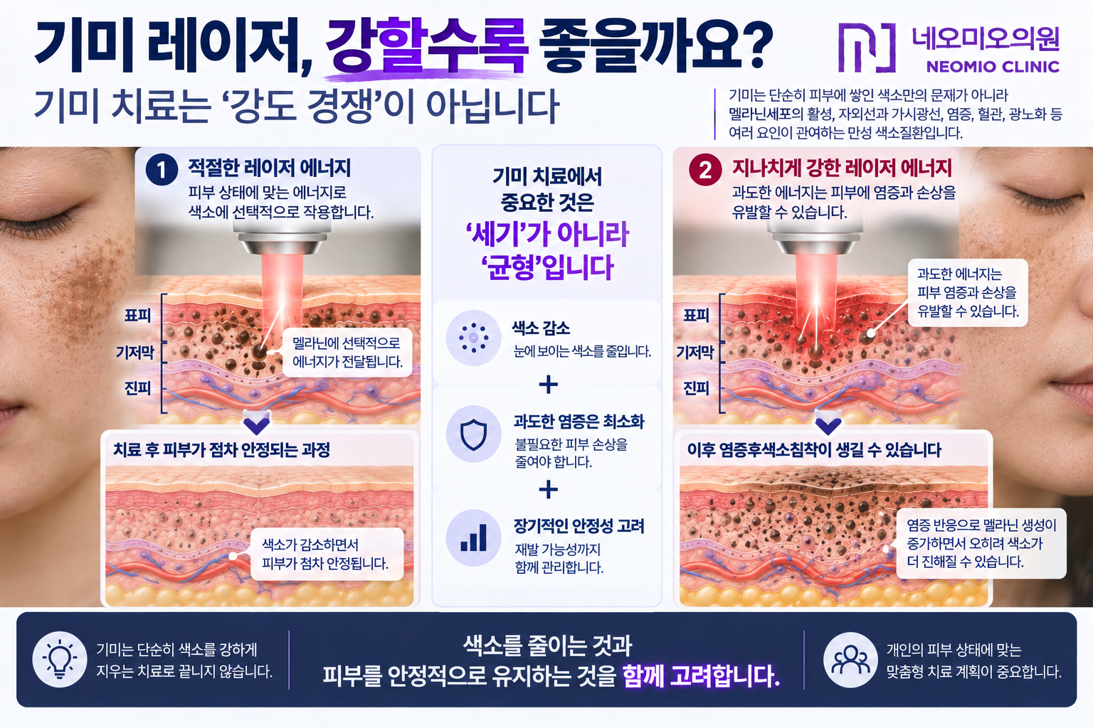 기미 레이저 치료에서 에너지를 무조건 높이는 것이 좋은 결과를 의미하지 않으며 과도한 피부 염증과 염증후색소침착 가능성을 함께 고려해야 하는 이유를 설명한 이미지
