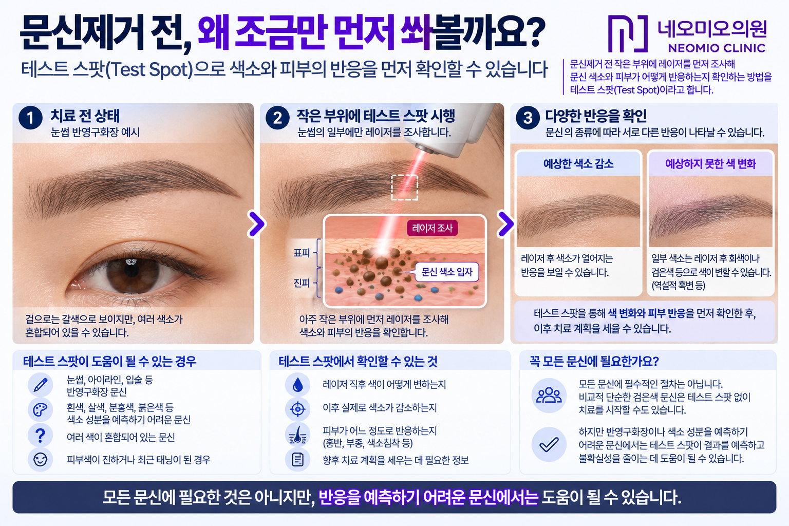 반영구화장이나 색소 성분을 예측하기 어려운 문신에서 전체 레이저 치료 전에 작은 부위에 테스트 스팟을 시행해 색 변화와 피부 반응을 확인하는 과정을 설명한 이미지