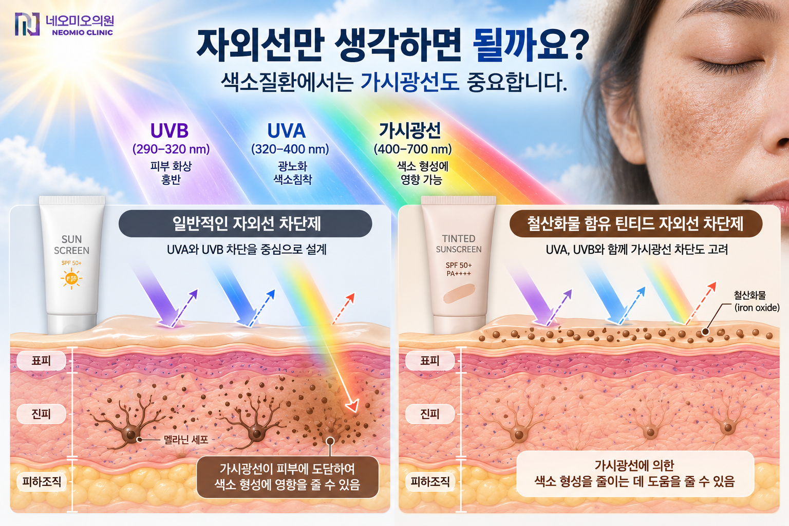 자외선과 가시광선이 피부 색소 형성에 미치는 영향과 철산화물 함유 틴티드 자외선 차단제를 이용한 가시광선 광보호 원리를 설명하는 이미지